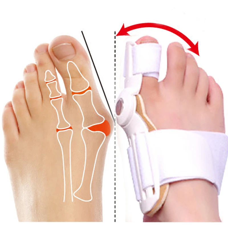 1 Pair Hallux Valgus Corrector Splint Correction Bunion Corrector Thumb Orthopedic Bone Toe Separator Foot Care Pedicure Tools