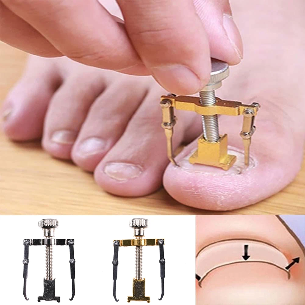 Ingrown Toenail Toe Fixer Recover Correction Pedicure Foot Nail Care Tool toe Special ingrown nail corrector for nail groove