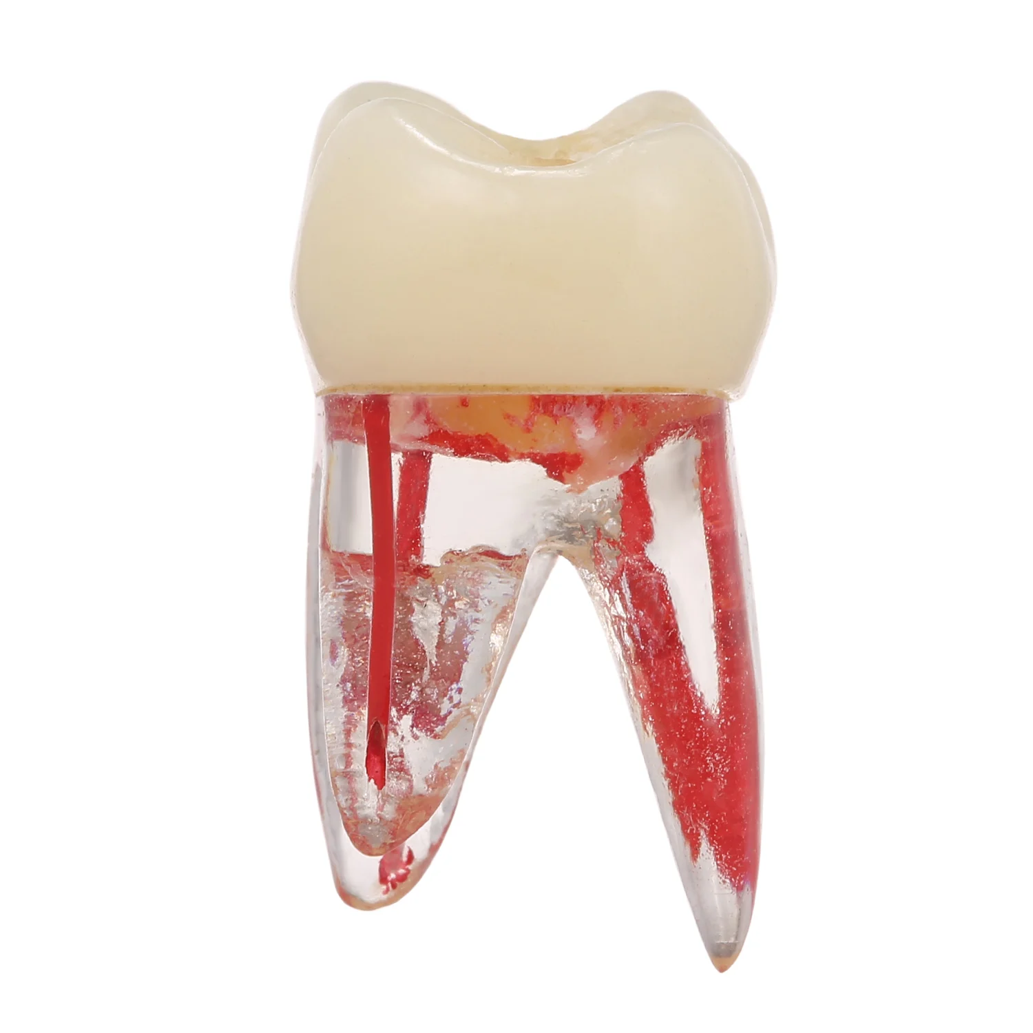 1:1 смоляная Стоматологическая эндодонтическая Студенческая Учебная модель с цветным корневым каналом и целлюлозно-прозрачной