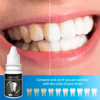 

Teeth Whitening Smoke Coffee Tea Stain Remove Top Dental Tooth Care Oral Hygiene Serum Gel Teeth Cleaning Essence