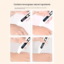 60 г шампунь мыло против перхоти контроль масла Питательный Уход за волосами аромат мыло ручной работы SCI88