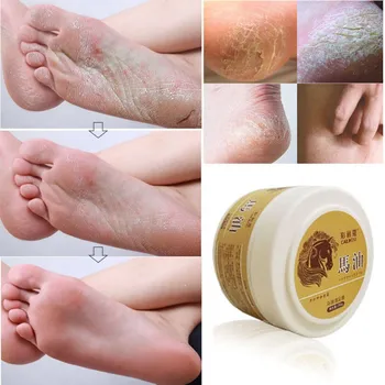 

Cracked Heel Cream Dry Cracked Remove Dead Skin Soften Foot Cracked Heal Repair Cream Foot Care
