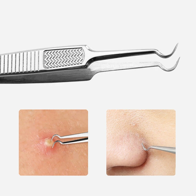 1PC Curved Straight Blackhead Tweezers Double Head Acne Anti Slip Stainless Steel Needle Removal Tool |