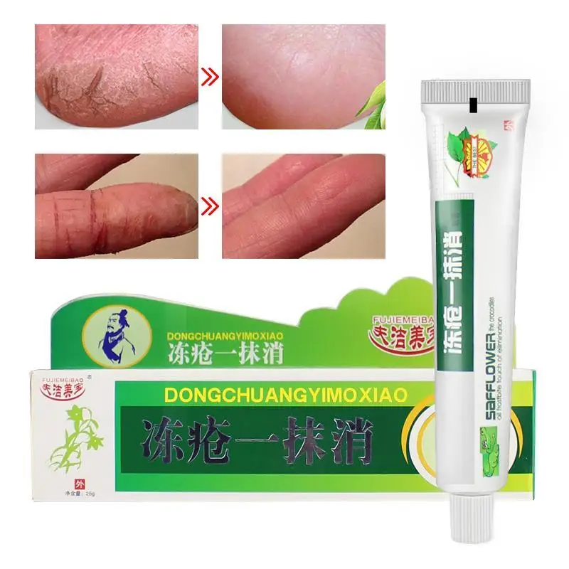 Powerful Chinese Medicinal Ointment Hand Foot Crack Cream Heel Chapped Peeling Repair Frostbite Anti Dry Skin Creams | Красота и