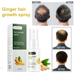 Hair Growth Essence Spray Fluid Anti Loss Treatment Ginger Essence Fast Hair Growth Prevent Damage Plant Extracts Liquid 20ml