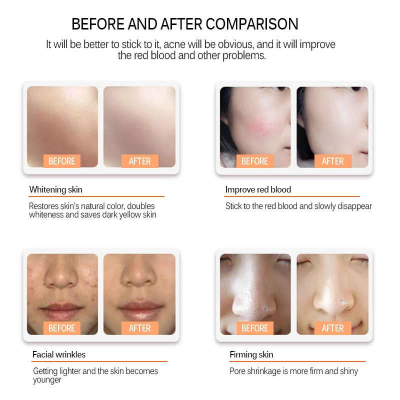 Дерма ручка завальцовки MYM микроиглы Ручка микро винтовой порт иглы картридж BB