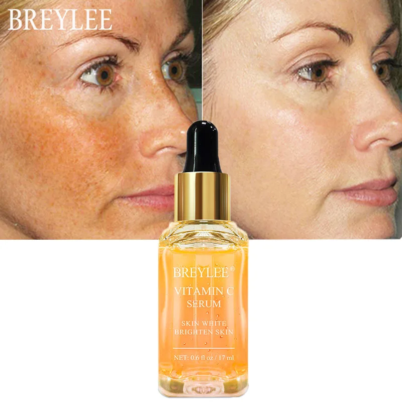 

BREYLEE Vitamin C Face Serum Whitening Brighten Skin Facial Essence Skin Care Fade Dark Spots Remove Freckle Dark Circle Remover