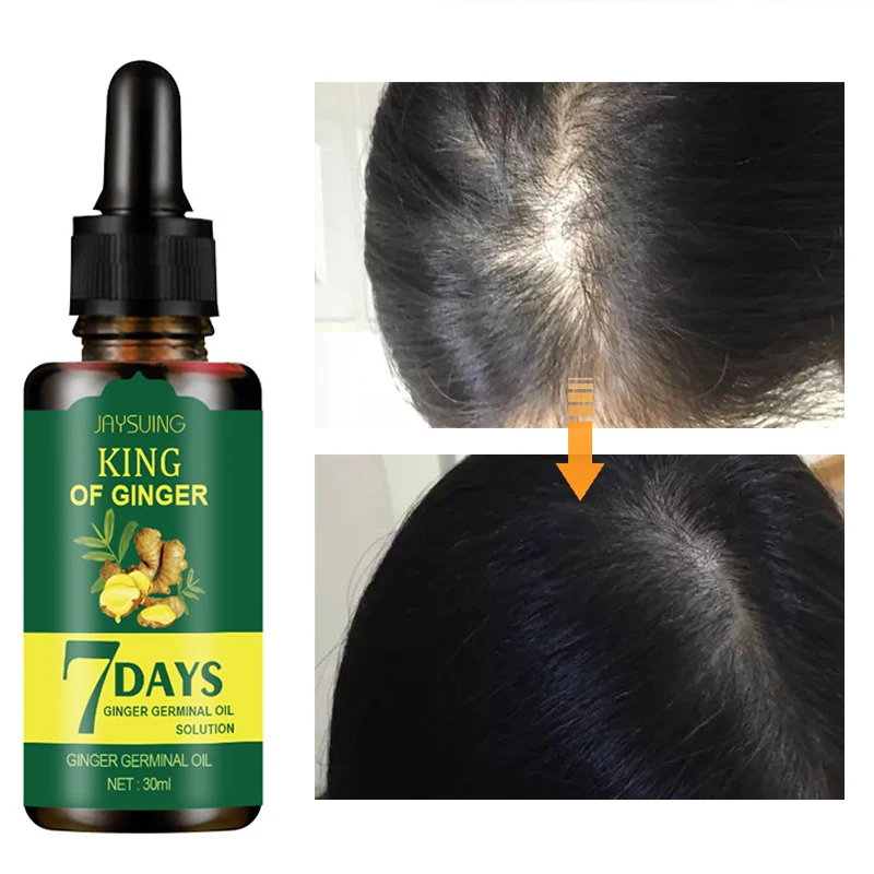 Esencia para el crecimiento del cabello de jengibre, 7 días de esencia Germinal para la pérdida de cabello, suero de raíces, aceite para hombres y mujeres, tratamiento para la pérdida de cabello