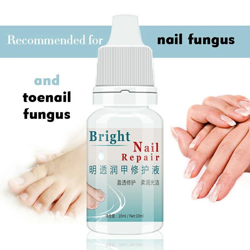 Rapid Deep Sterilization Protect Nail Treatment Solution Toenail Anti Fungus Repair Liquid Moisturizing TSLM2