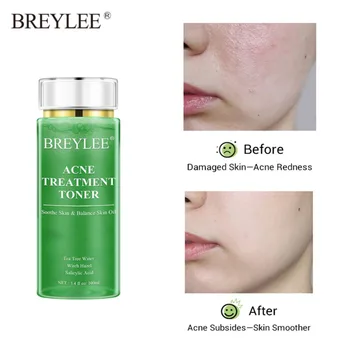 

BREYLEE Acne Treatment Toner Pimple Soothing Relieve Acnes Oil-Control Shrink Pores Acne Scar Removal Tea Tree Face Serum 100ml