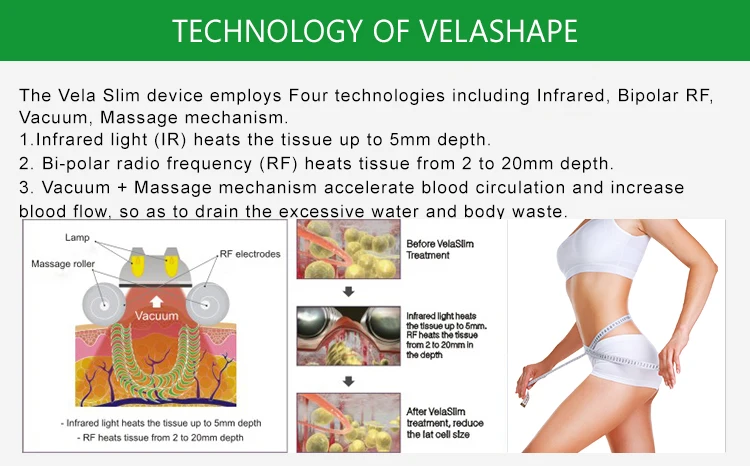 Лучшие продажи rf роликовый массаж кожи Velashape цена потери жира тела шейпинг машина для похудения