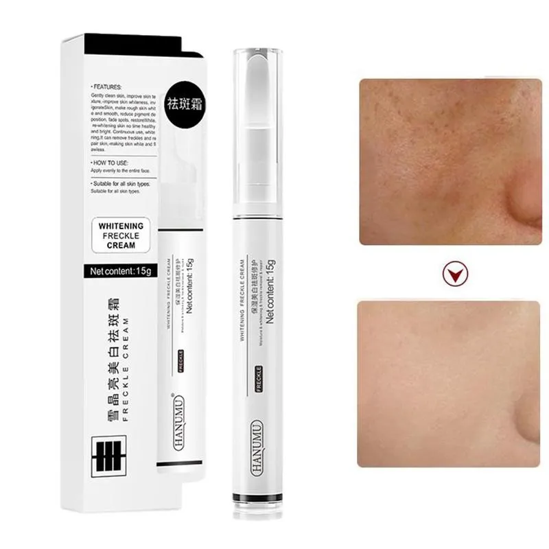15ml Vitamin C Frekle Cream Whiten Skin Repair Fade Acne Marks Remove Dark Sports Corrector Pen Moisturizing Lotion Serum 15ml Vitamin C Frekle Cream Whiten Skin Repair Fade Acne Marks Remove Dark Sports Corrector Pen Moisturizing Lotion Serum