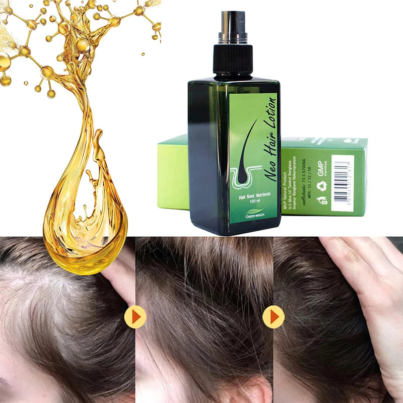 Neo Hair Lotion 120ml Paradise Made In Thailand Regenerative Hair Care Prevent Loss Root Capillary Growth Serum Oil
