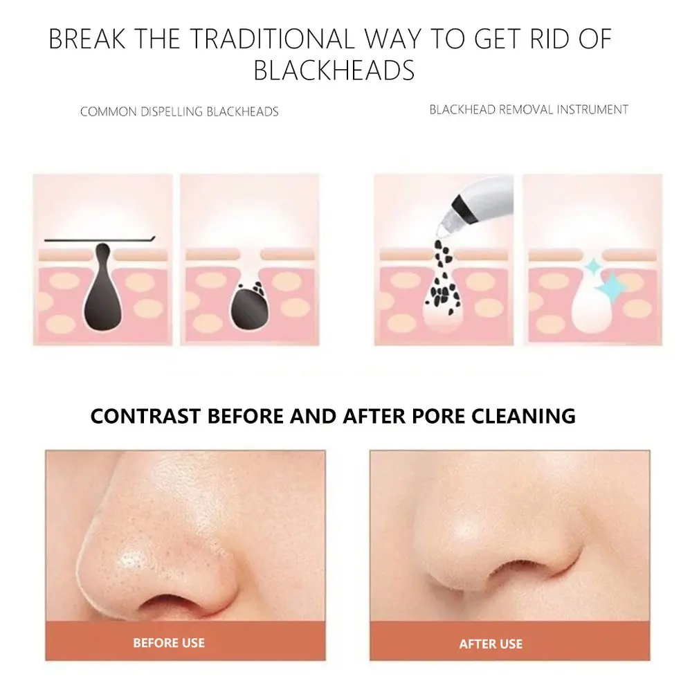 Portable USB Rechargeable Pores Vacuum Electric Face Pore Cleaner Blackhead Remover Acne Suction Facial Cleaning Tool
