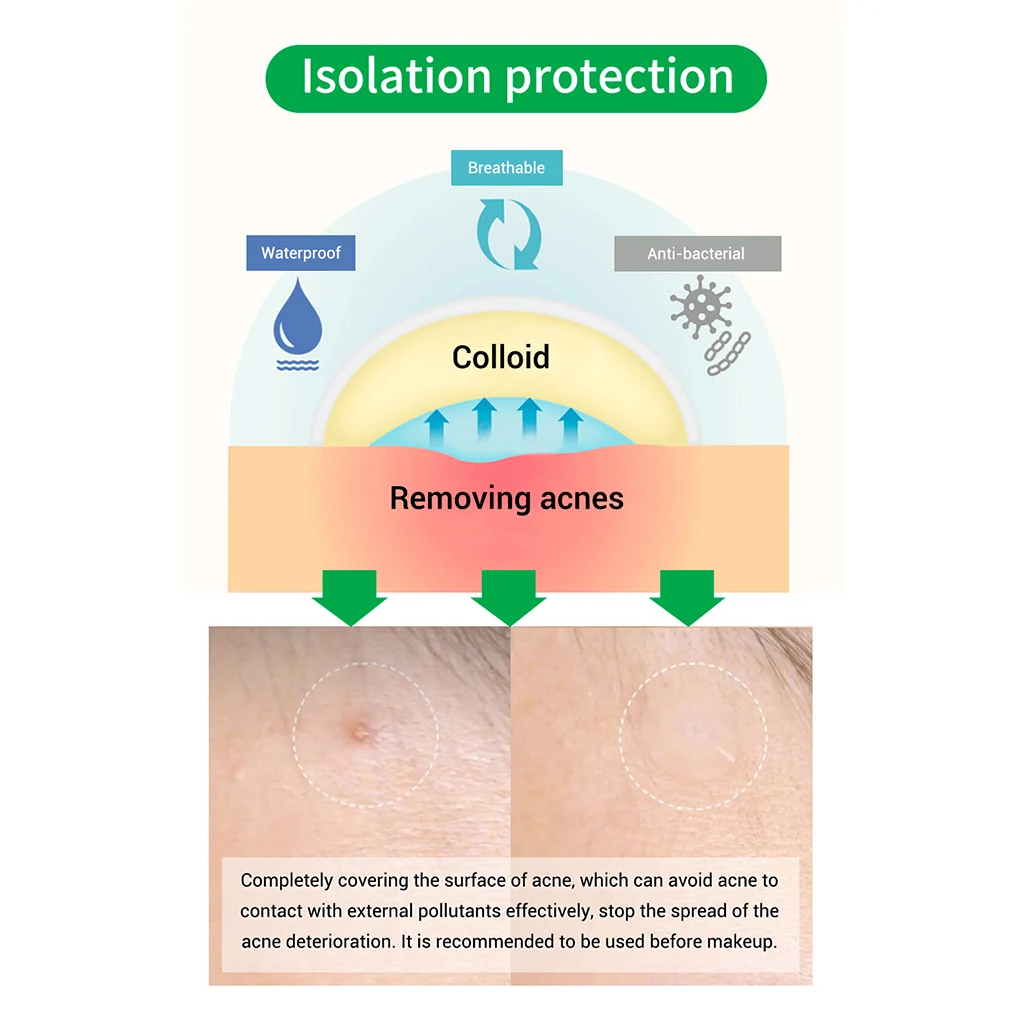22pcs/sheet Breylee Tea Tree Acne Remover Patch Face Dots Spot Scar Stickers Facial Masks Pimples Remover Tools Face Mask 