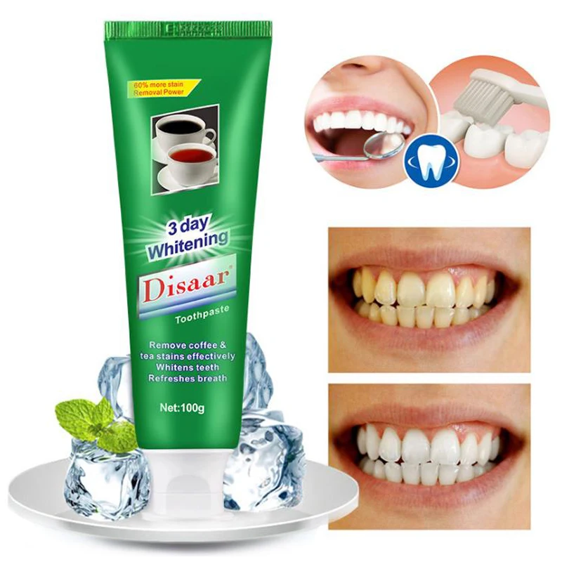 паста отбеливающая зубы. паста для отбеливания. зубная паста splat экстра отбеливание, 75 мл. зубная паста medibeau toothpaste clinic 120 гр. чёрная зубная паста для отбеливания зубов.