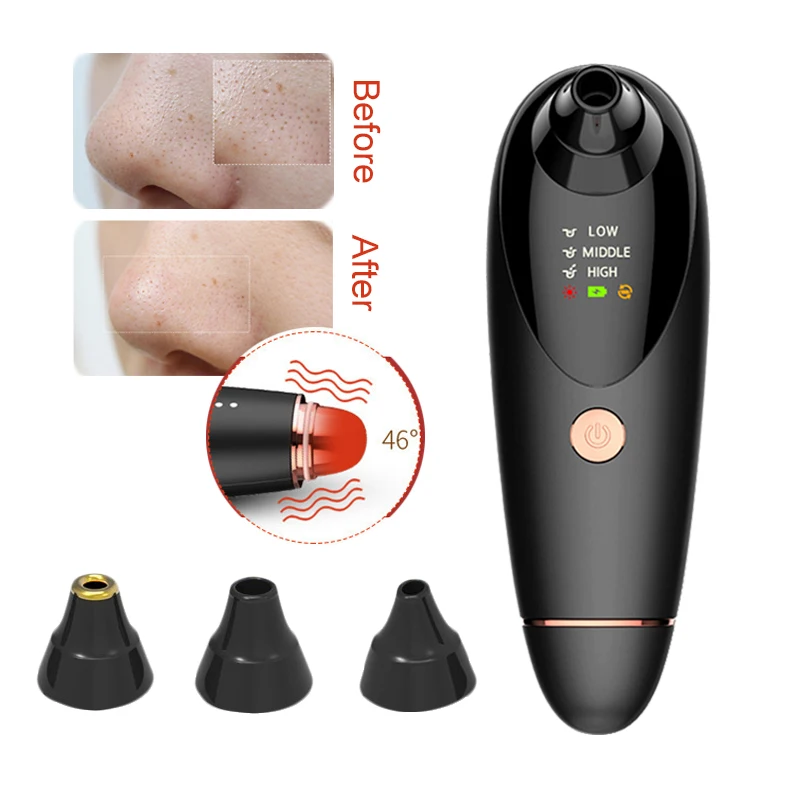 Vacuum Face Nose Pore Cleaner Electric Blackhead Remover Skin Care Hot Compress Pore Suction Tool Acne Pimple Removal Machine