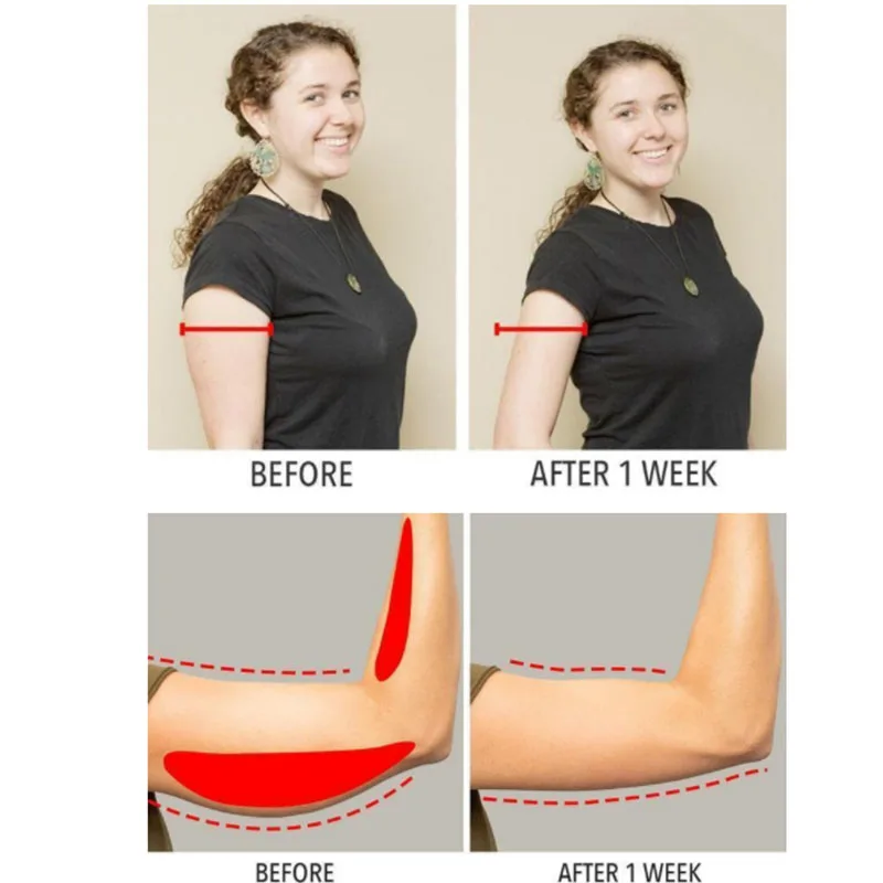 1Pair Slimming Compression Arm Shaper Slimming Arm Belt Helps Tone Shape Upper Arm Shaper Arm Shaping Sleeves for Women