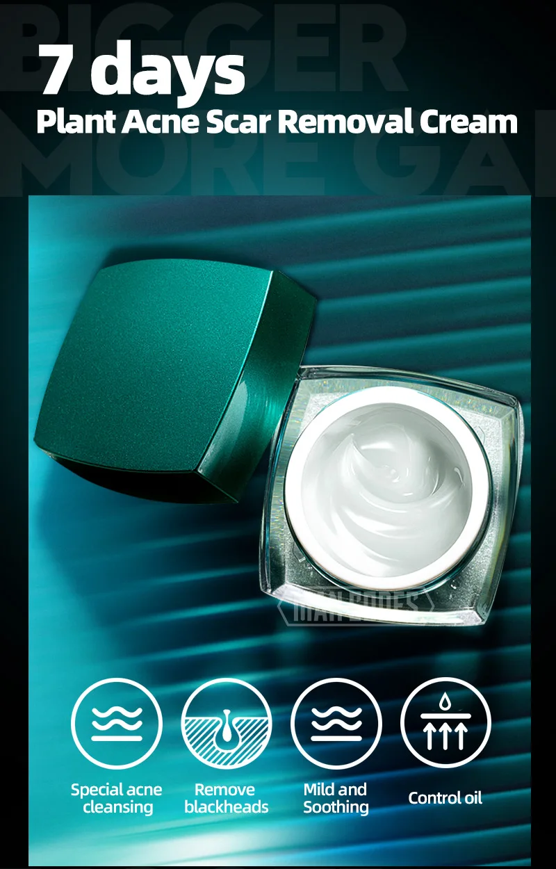 左颜右色祛痘膏-水印_01