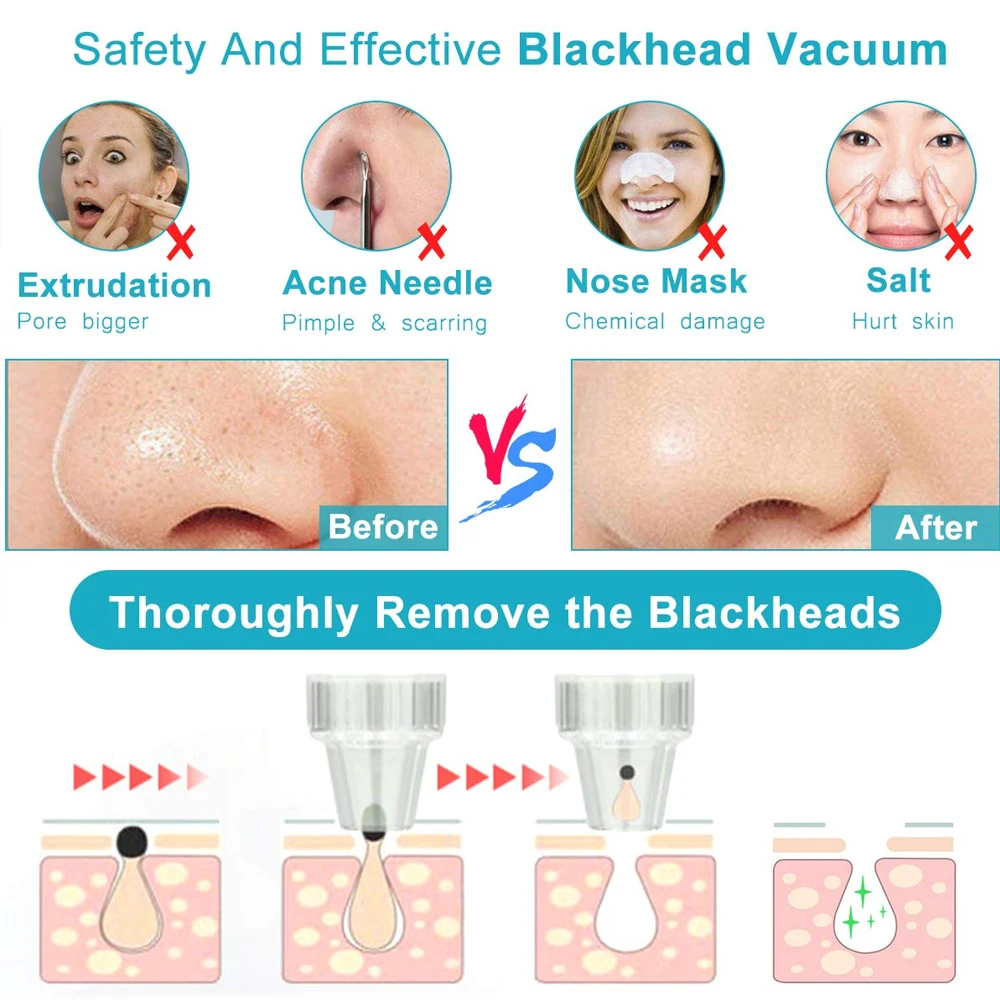 Clear Beauty Remove Blackhead Blackhead Removal Equipment ABS White Black Head Cleaner Cosmetic Instrument Fashion Effective