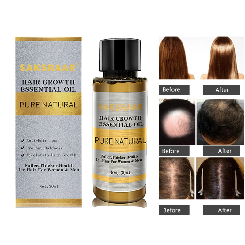 hair loss helper essential oil blend