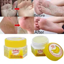 

Anti Fungal Hand Foot Heel Anti-Drying Crack Repair Banana Oil Massage Cream Nourish Gentle Skin Care Banana Oil Repair