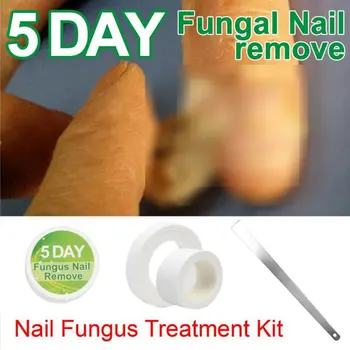 

Chinese Medicine Herbs Toe Nail Fungus Treatment Removal Nail Care Cream Kit Anti Infection