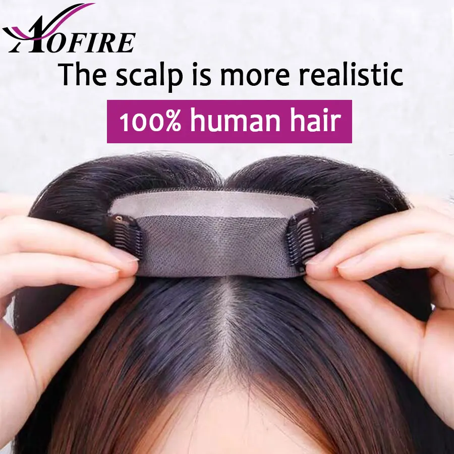 头皮对比 - 副本