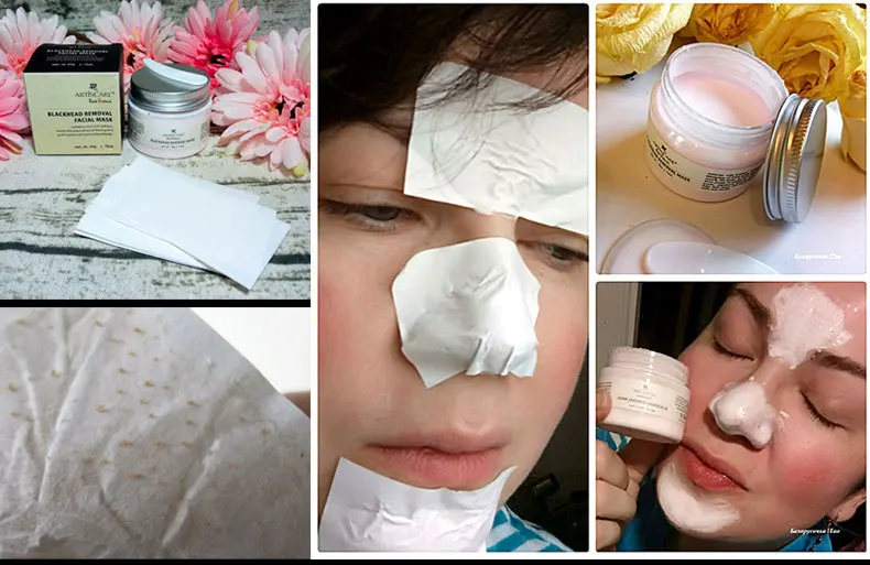 blackhead_01