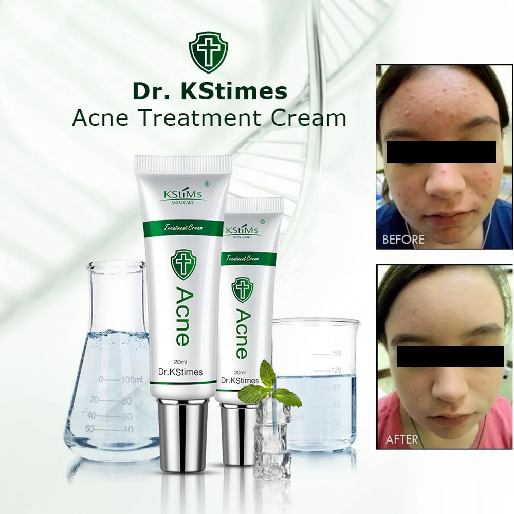 best acne for men