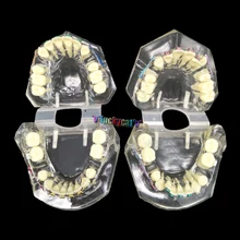 1 шт. зубная, Ортодонтическая модель с красочными кронштейнами модели неправильного прикуса обучающая модель Стоматологический материал инструменты для стоматолога