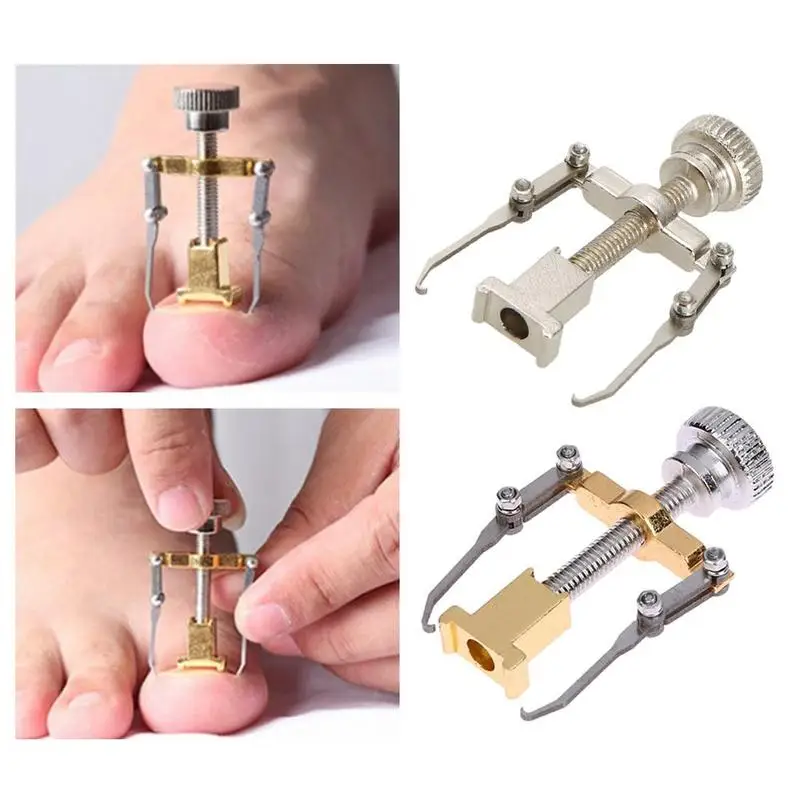 Metal Orthopedic Supplies Ingrown Toe Nail Recover Tool Pedicure Toenail Fixer Pedicure Foot Nail Care Nail Bunion Corrector