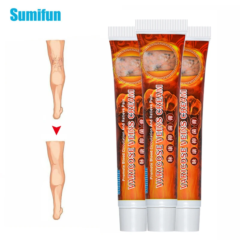 3 шт. Sumifun 2020 Новый варикозное расширение вен лечение мазь 100% оригинальный