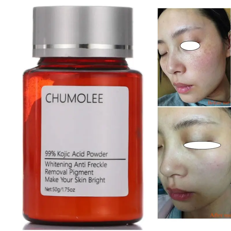 CHUMOLEE отбеливающий крем для лица с 99% кожевой кислотой удаление веснушек меласмы