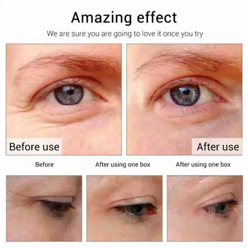 30 Pair=60 Sticker Seaweed Hyaluronic Acid Eye Mask Age Remove Aging Eye Dark Moisturizing Anti Bag Wrink Serum Patches Cir O7R2