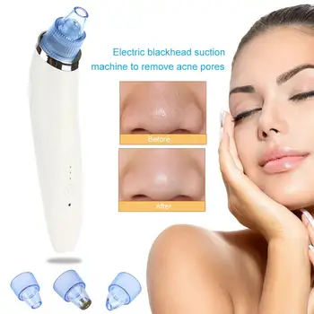 

Electric Vacuum Pore Cleaner Skin Care Women Beauty Face Pore Sucker Blackhead Acne Cleansing