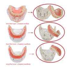 1 шт., зубной имплантат, модель зубов, восстановление протезов, прозрачный 6001, верхний 6003, нижний 6002, нижний имплантатный/нижнечелюстный
