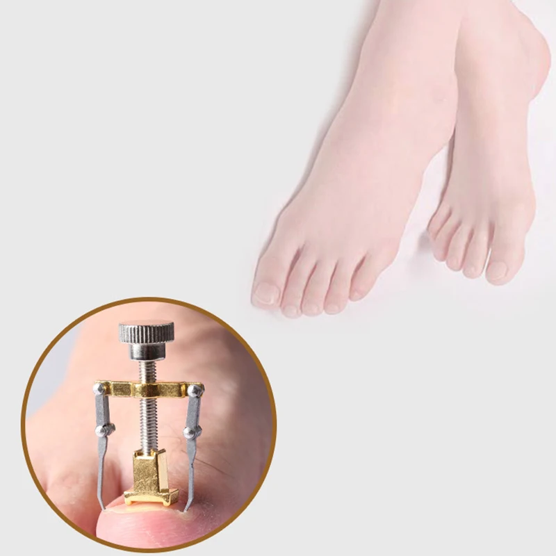 Ingrown Toenails Toe Nail Care Tool Professional File Corrector Device Pedicure Foot Bunion Corrector Protector