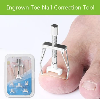 

1 Set Stainless Steel Ingrown Toenail Correction Tool Nail Corrector Tool Kit Toe Paronychia Nail Brace Pedicure Care Tool