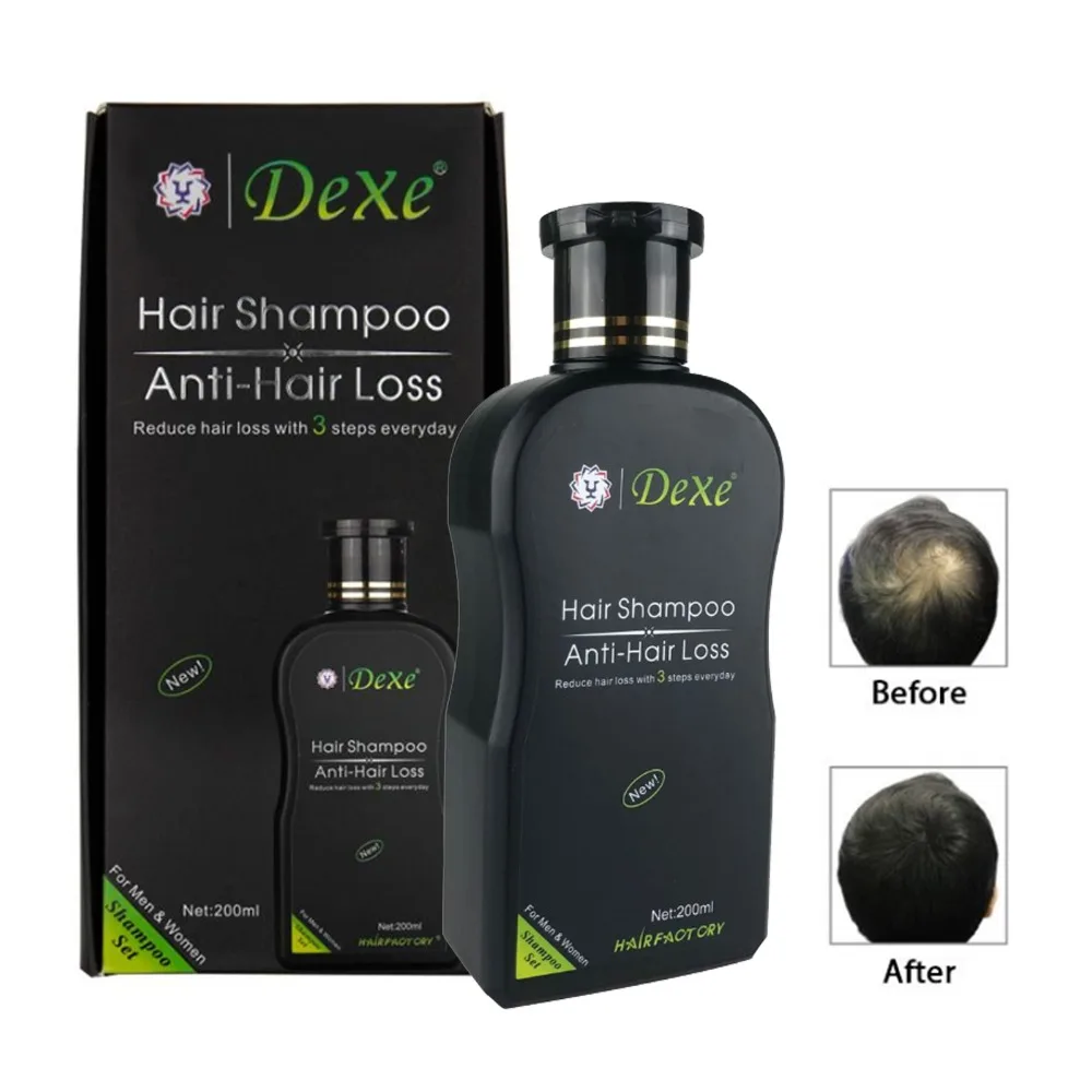 Dexe профессиональный анти шампунь против выпадения волос для волос Regrowth китайские средства для роста волос предотвращает лечение волос мужчин t для мужчин и женщин