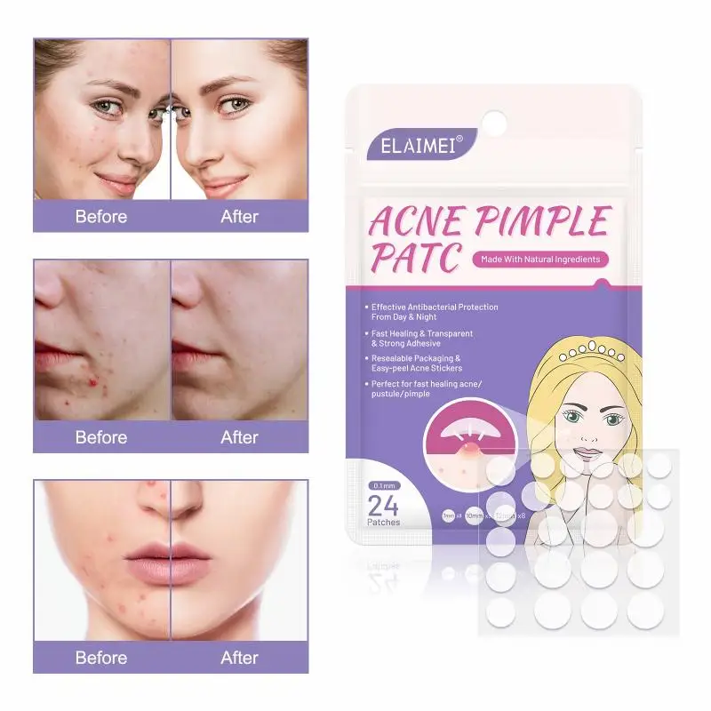 Elaimei 24pcs Skin Tag Remover Pimple Master Patch Treatment Invisible Acne Stickers Patch Skin Acne Concealer Face Makeup Tools Facial Care Tool Aliexpress