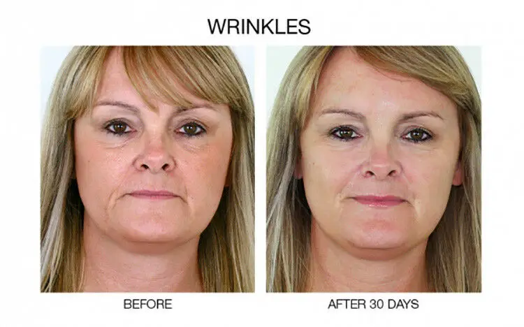 matrixyl niacinamide