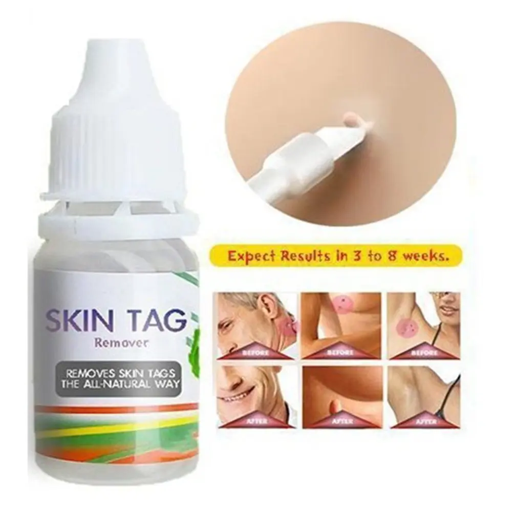 

Pedicure Tools Callus Remover Hands Feet Skin Fungistat Bacteriostatic Agent Flat Wart Removal Liquid Eye Patch