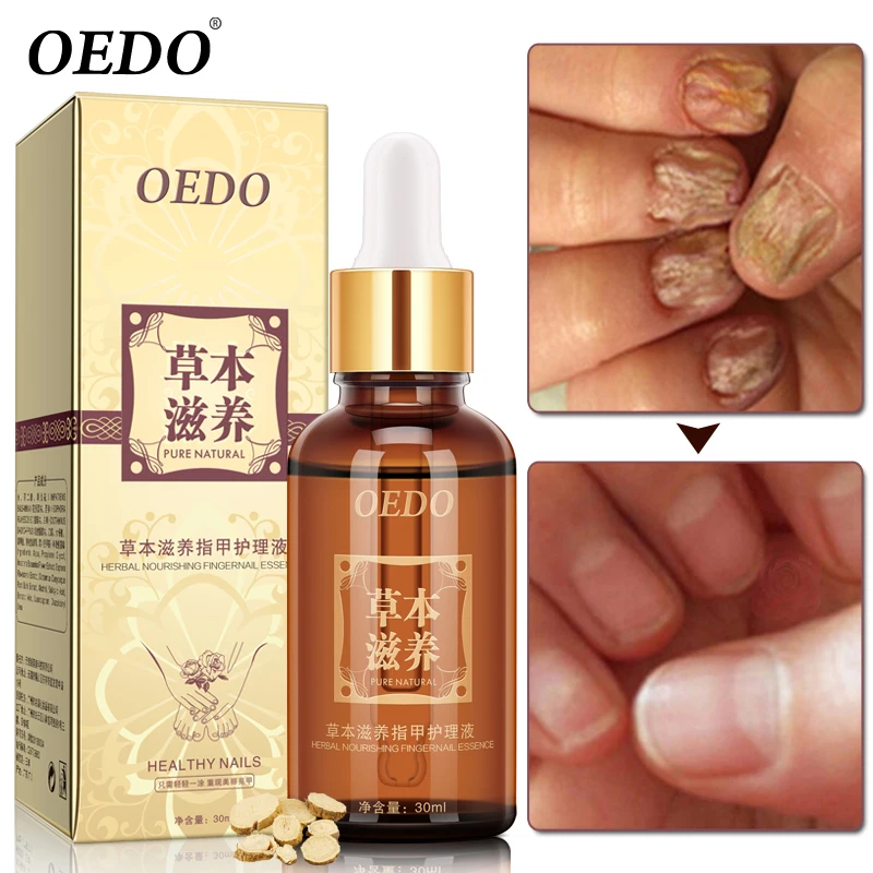OEDO Nail Treatment Essential oil Hand and Foot Onychomycosis Toe Nail Fungus Removal Infection Feet Care 30ml OEDO Nail Treatment Essential oil Hand and Foot Onychomycosis Toe Nail Fungus Removal Infection Feet Care 30ml