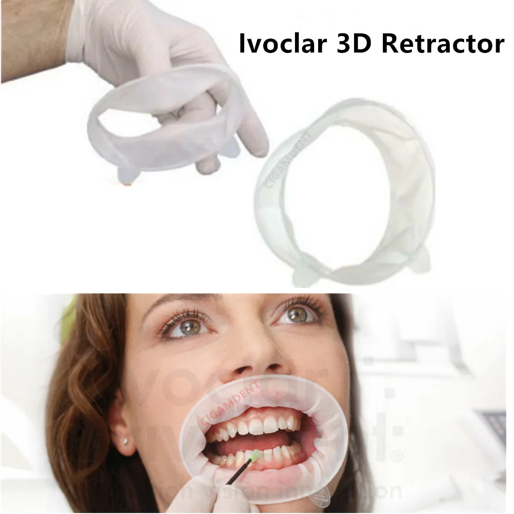 

2-50pieces OptraGate 3D Dental Mouth Opener Lip Cheek Retractor O Shape Teeth Whitening Regular Adult 7CM