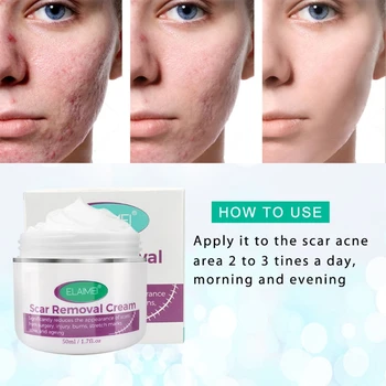 

Scar Removal Cream Scars Treatment Skin Repair for Face Body Acne Spots E65F