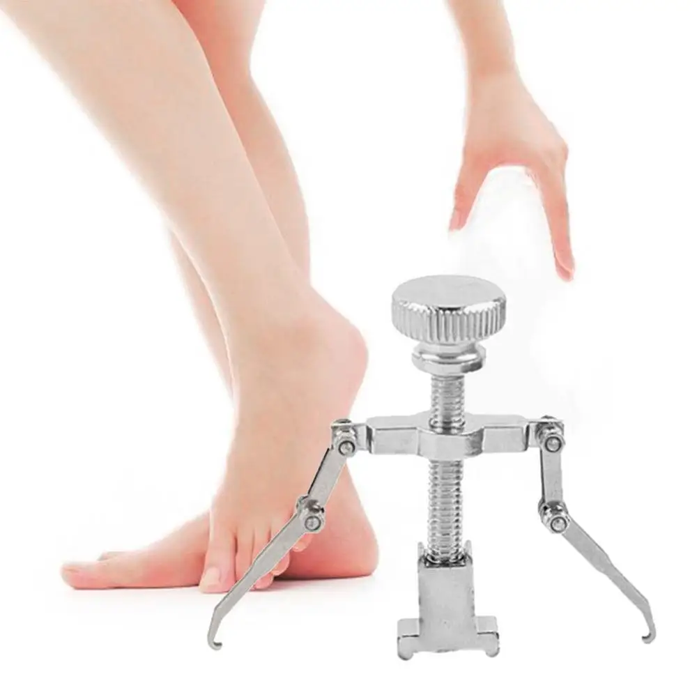 Коррекция вросших ногтей OPHAX прочная клипса для коррекции из нержавеющей стали