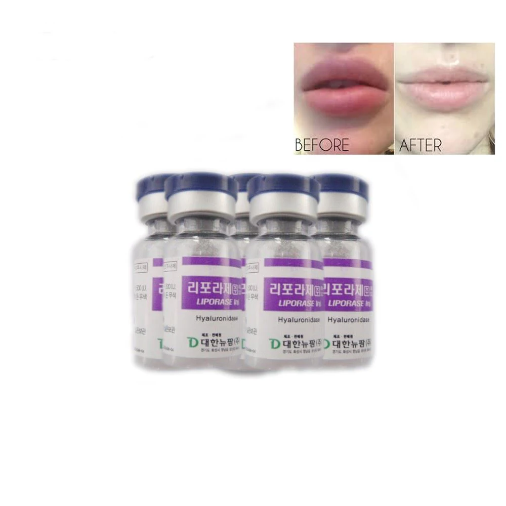 

high quality Hyaluronidase dissolve Hyaluronic Acid dermal filler Injection