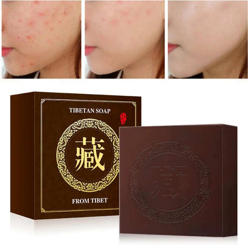 Tibetan Formula Hand-made Soap Moisturizing Oil-Control Remove Blackheads Anti-Acne Anti-Mite Firming Skin Herbal Soap Skin Care