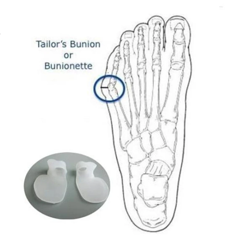 Силикагель 10 шт уход за ногами Bunion маленький носок исправление шишки на ноге разделители ног для Педикюр Инструменты Уход за ногами